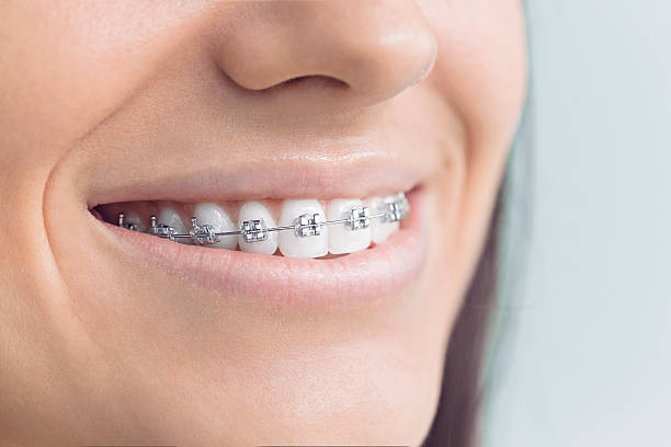 Best Teeth Whitening  in Schaumburg, IL